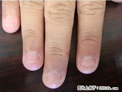 剪指甲、挖耳屎，这些日常小动作竟隐藏大危害！ - 阿拉善盟生活资讯 - 阿拉善盟28生活网 alsm.28life.net